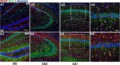 Immunohistochemistry: EAAT2/GLT1 Antibody - Azide Free [NBP1-20136]